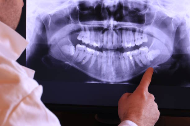 Best Emergency Treatment for Dental Infections or Abscesses in Raeford, NC